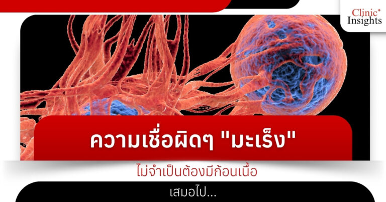 ความเชื่อผิดๆ _มะเร็ง_ ไม่จำเป็นต้องมีก้อนเนื้อเสมอไป