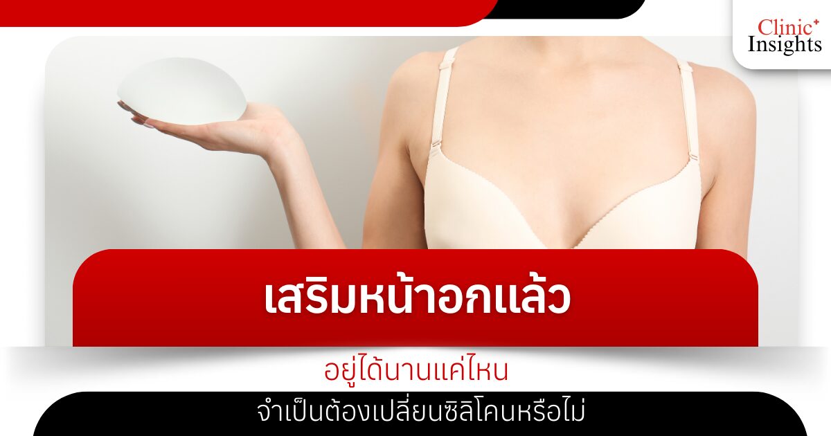 เสริมหน้าอกแล้ว อยู่ได้นานแค่ไหน จำเป็นต้องเปลี่ยนซิลิโคนหรือไม่
