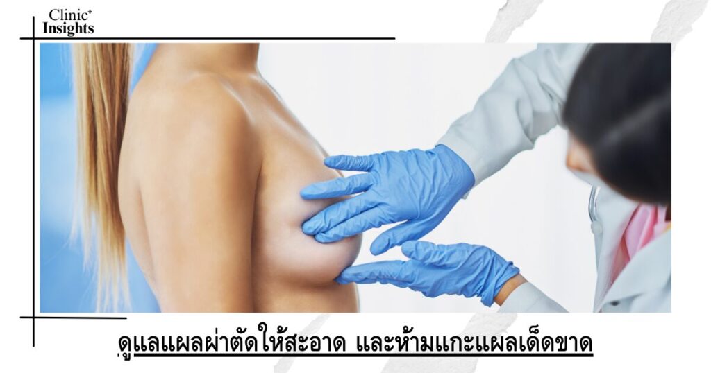 ดูแลแผลผ่าตัดให้สะอาด และห้ามแกะแผลเด็ดขาด