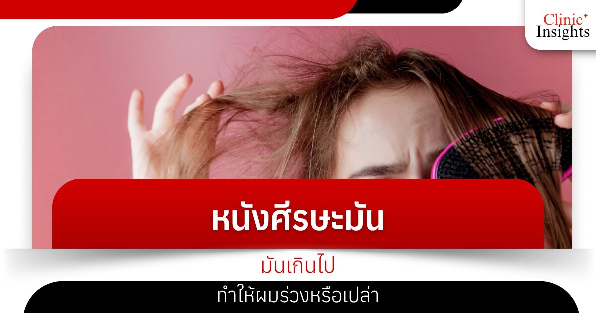 หนังศีรษะมันเกินไปทำให้ผมร่วงหรือเปล่า