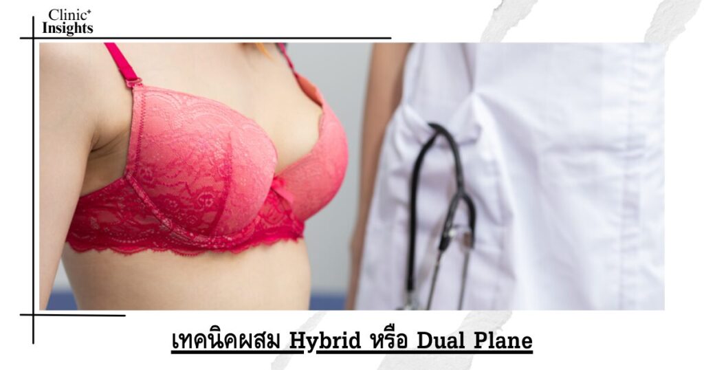 เทคนิคผสม Hybrid หรือ Dual Plane