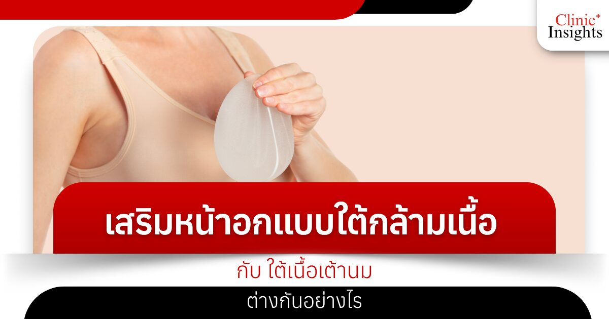 เสริมหน้าอกแบบใต้กล้ามเนื้อ กับ ใต้เนื้อเต้านม ต่างกันอย่างไร