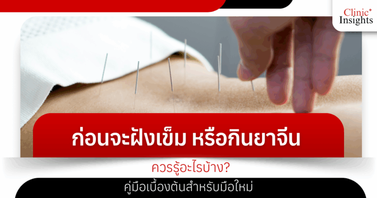 What should you know before getting acupuncture or taking Chinese medicine? A beginner's guide