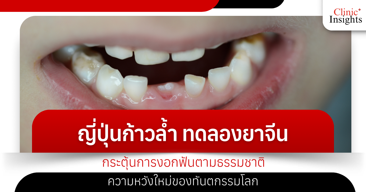Japan is taking the lead in testing Chinese medicine to stimulate natural tooth growth, a new hope for global dentistry.