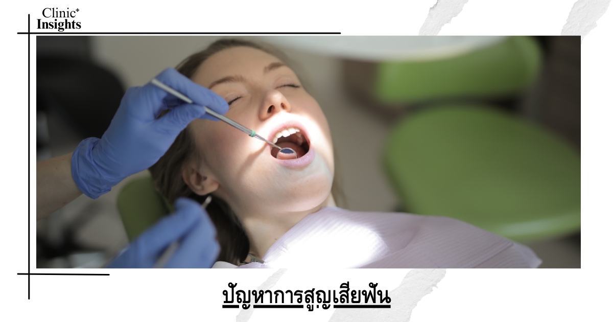 The global problem of tooth loss