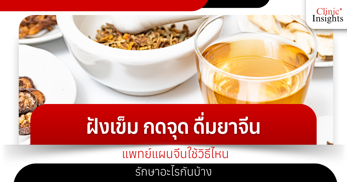 Acupuncture, acupressure, and Chinese medicine: What methods do Chinese medicine practitioners use to treat certain conditions?