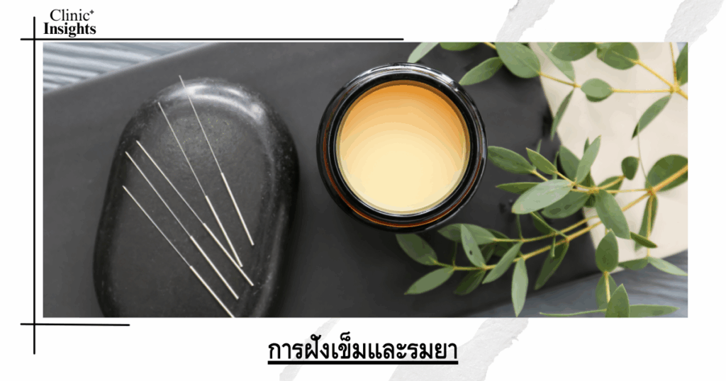 Acupuncture and moxibustion