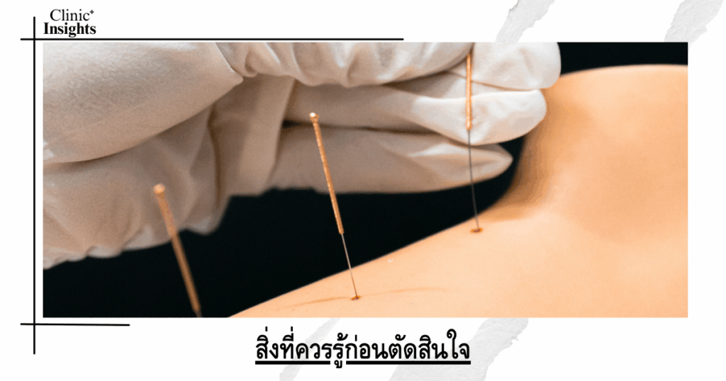 Things to know before deciding