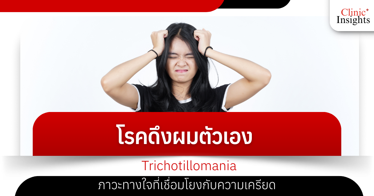 Trichotillomania (hair-pulling disorder), a mental health condition linked to stress