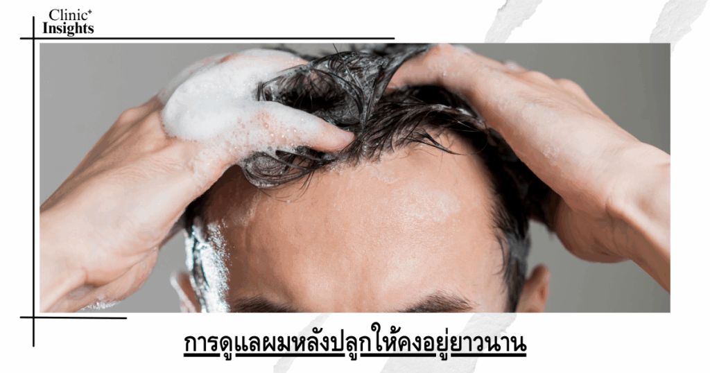 Caring for long-lasting hair after transplantation