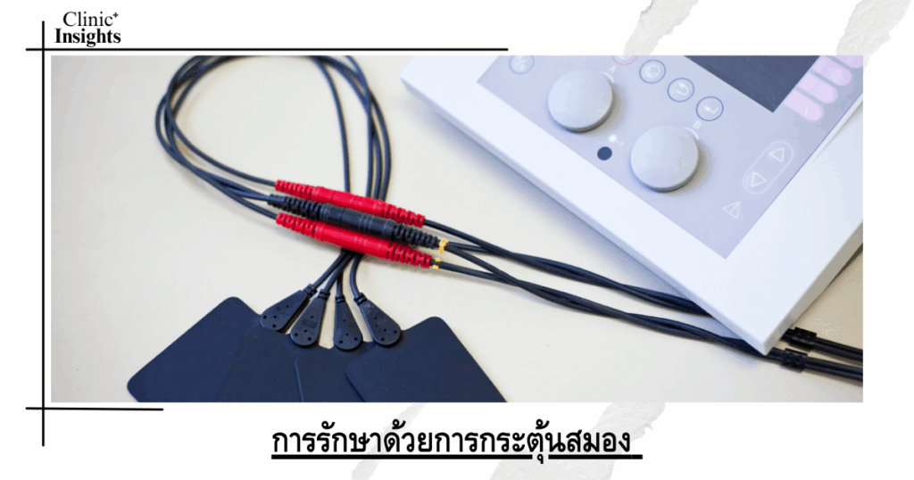 Brain Stimulation Therapies