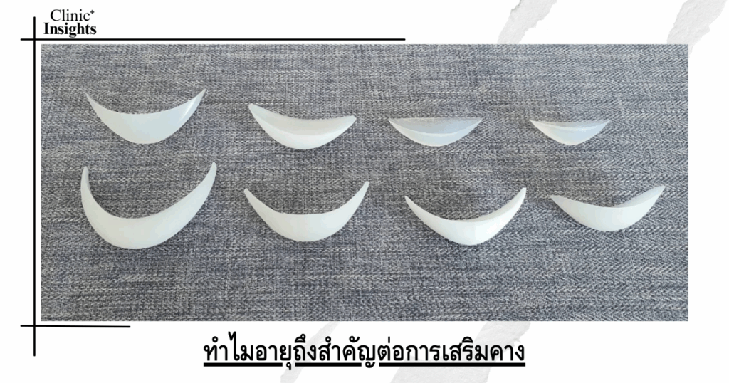 Why does age matter when it comes to chin augmentation?