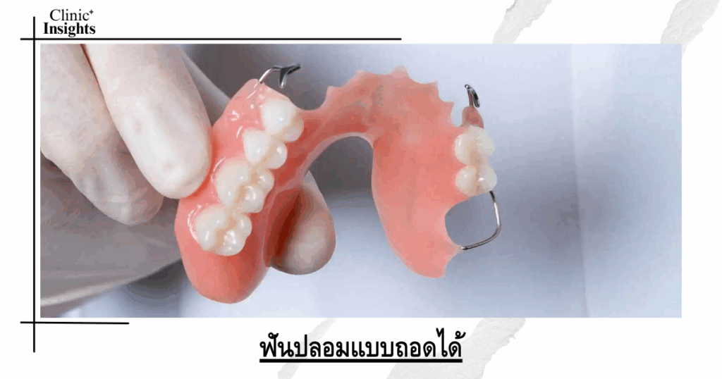 Removable dentures