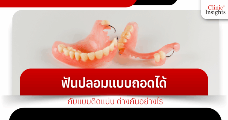 What is the difference between removable and fixed dentures?