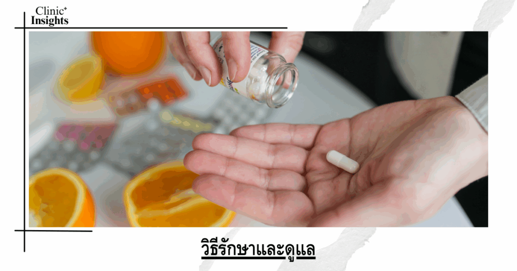 How to treat and care for