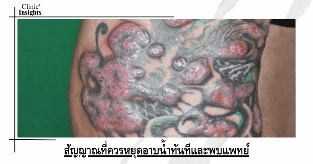 Signs that you should stop bathing immediately and see a doctor