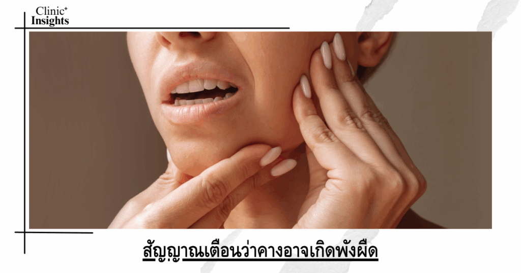 Warning signs that your chin may be suffering from scar tissue