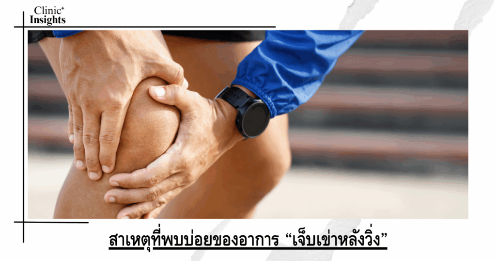 Common causes of “knee pain after running”