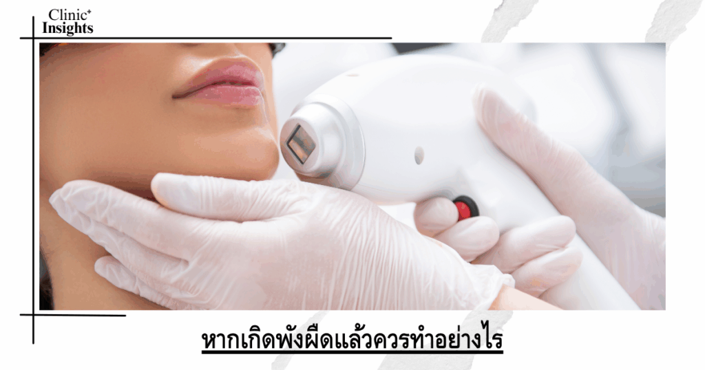 What should you do if scar tissue occurs?