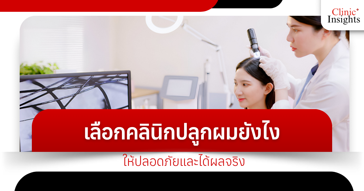 How to choose a hair transplant clinic that is safe and effective