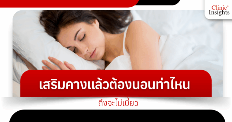 After chin augmentation, what position should I sleep in to prevent crookedness?