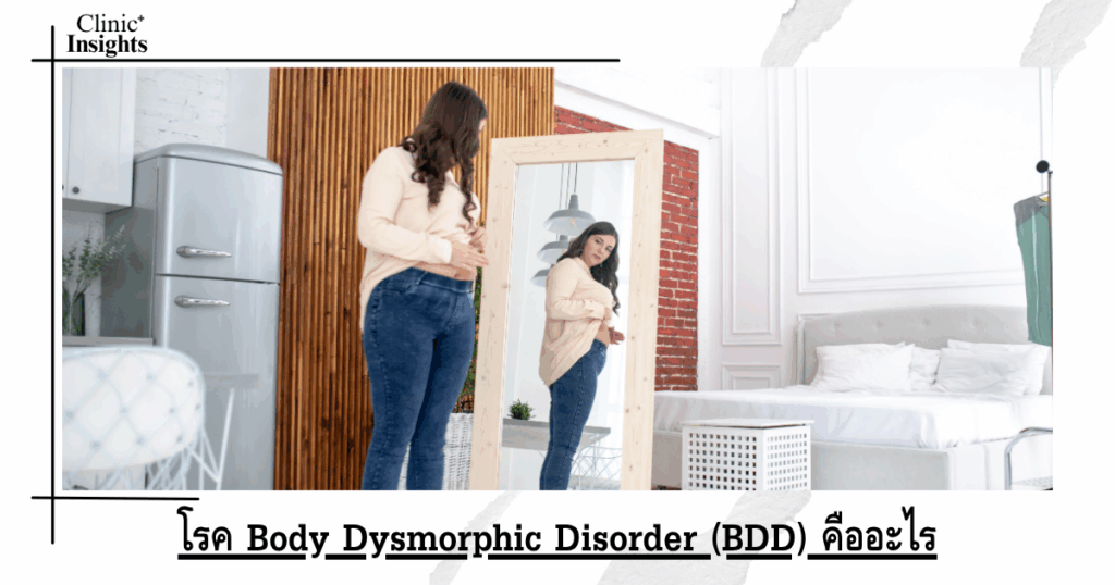 What is Body Dysmorphic Disorder (BDD)?