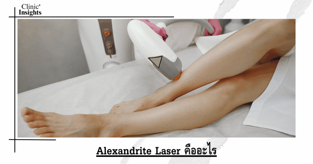 What is Alexandrite Laser?