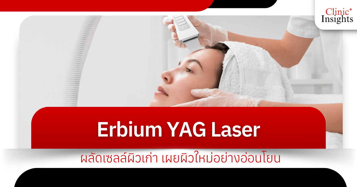 Erbium YAG Laser gently exfoliates dead skin cells, revealing new skin.