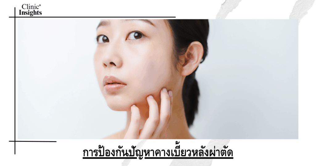 Preventing crooked chin after surgery