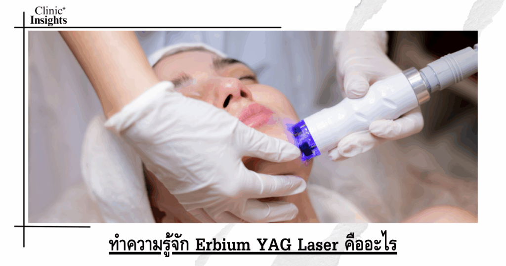 Get to know Erbium YAG Laser: What is it?