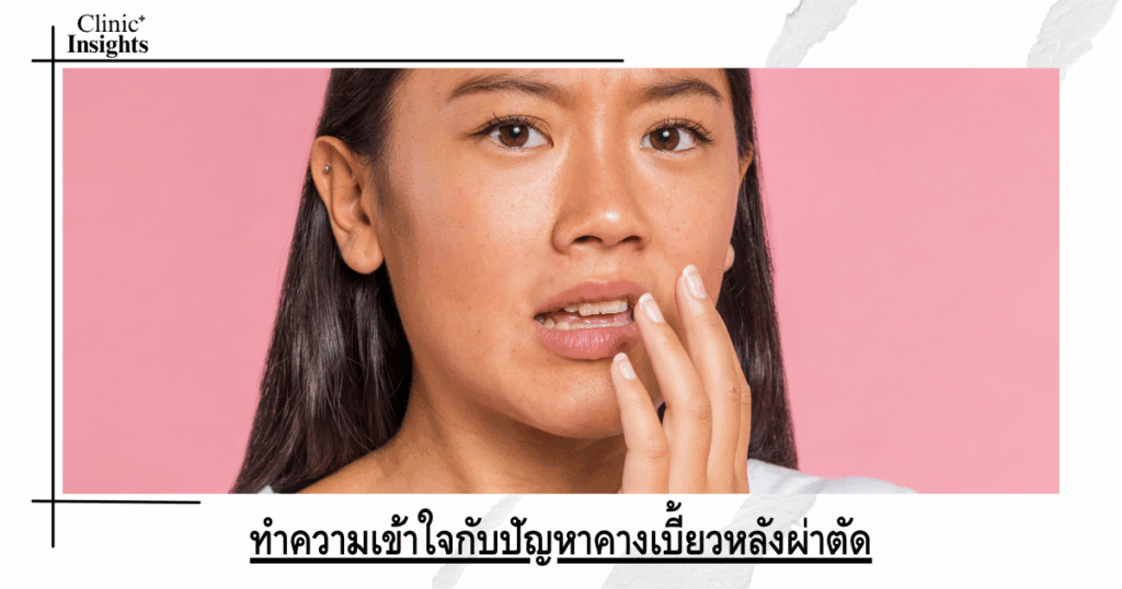 Understanding the problem of crooked chin after surgery