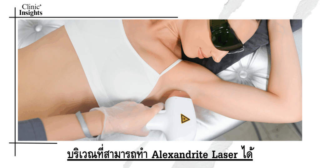 Areas where Alexandrite Laser can be performed