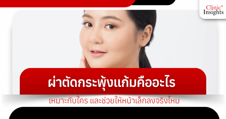 What is buccal surgery? Who is it suitable for? Does it really help make your face smaller?