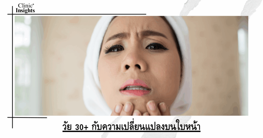 Age 30+ and changes on the face