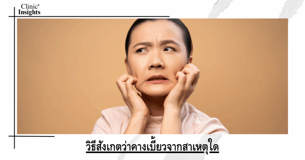 How to notice if your chin is crooked