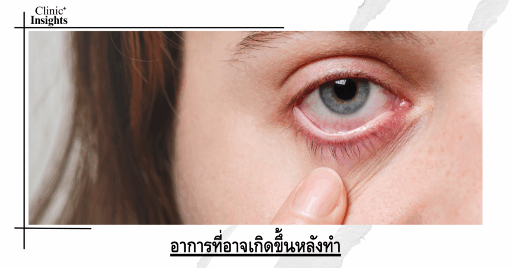 Symptoms that may occur after the procedure