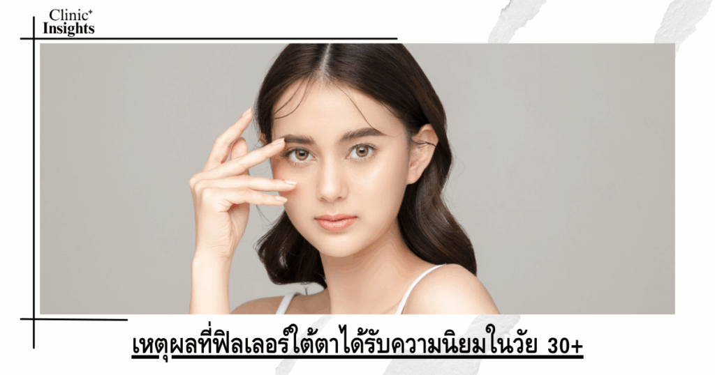 Why under-eye fillers are popular among people over 30