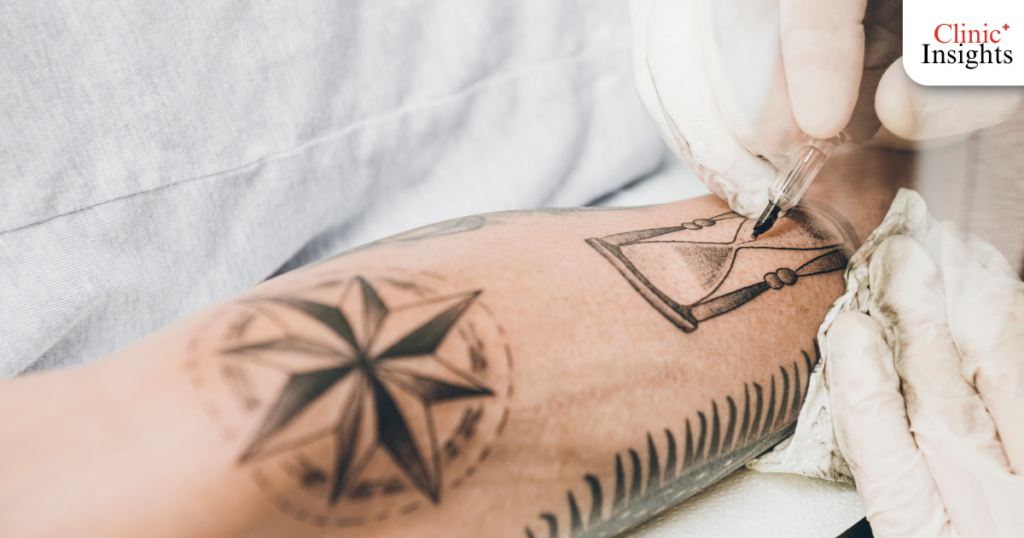 Anatomy of Tattoo (ทำไมรอยสักถึงติดทน?)