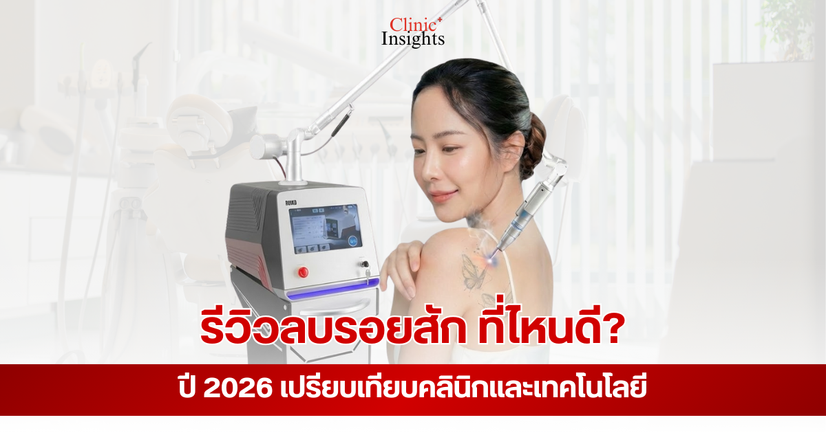 Tattoo removal review 2026 (1)