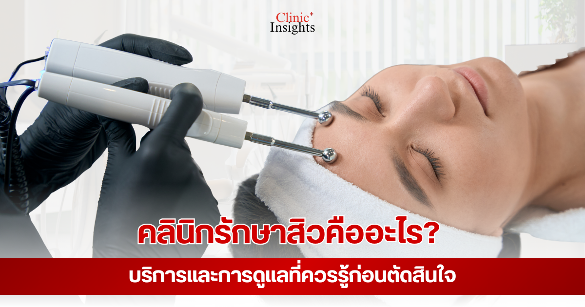 คลินิกรักษาสิวคืออะไร_ บริการและการดูแลที่ควรรู้ก่อนตัดสินใจ