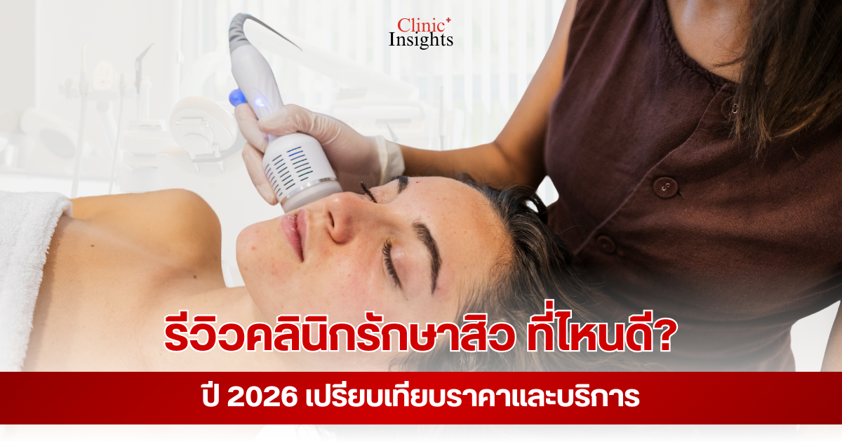 รีวิวคลินิกรักษาสิว ที่ไหนดี_ ปี 2026 เปรียบเทียบราคาและบริการ