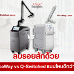 ลบรอยสักด้วย PicoWay vs Q-Switched แบบไหนดีกว่ากัน
