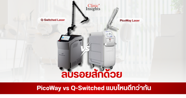 ลบรอยสักด้วย PicoWay vs Q-Switched แบบไหนดีกว่ากัน