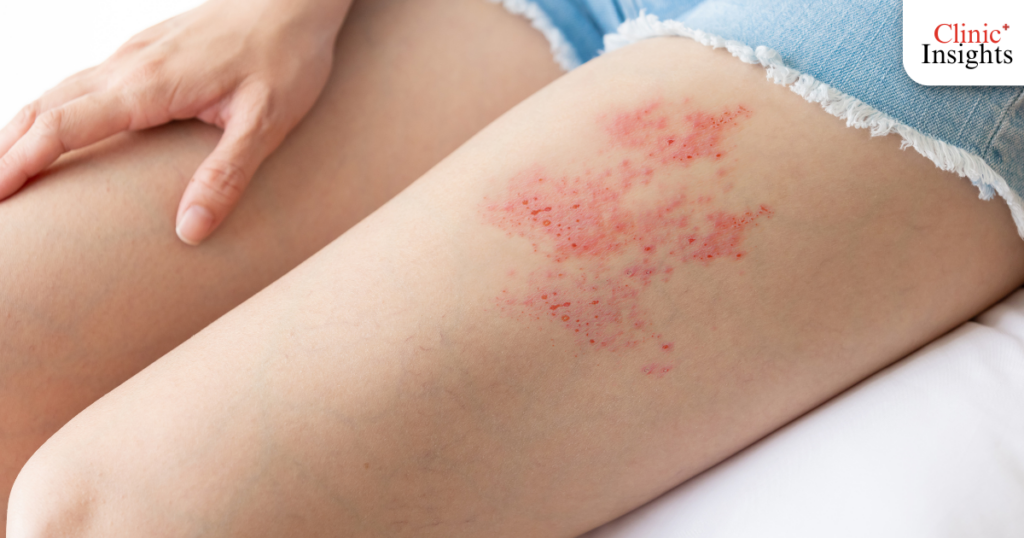 สัญญาณเตือน แบบนี้ต้องกลับไปหาหมอ!