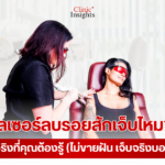 เลเซอร์ลบรอยสักเจ็บไหม ความจริงที่คุณต้องรู้ (ไม่ขายฝัน เจ็บจริงบอกจริง!) (1)