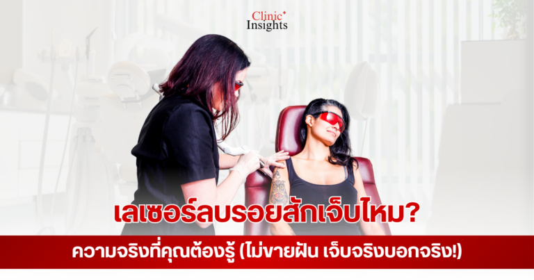 เลเซอร์ลบรอยสักเจ็บไหม ความจริงที่คุณต้องรู้ (ไม่ขายฝัน เจ็บจริงบอกจริง!) (1)