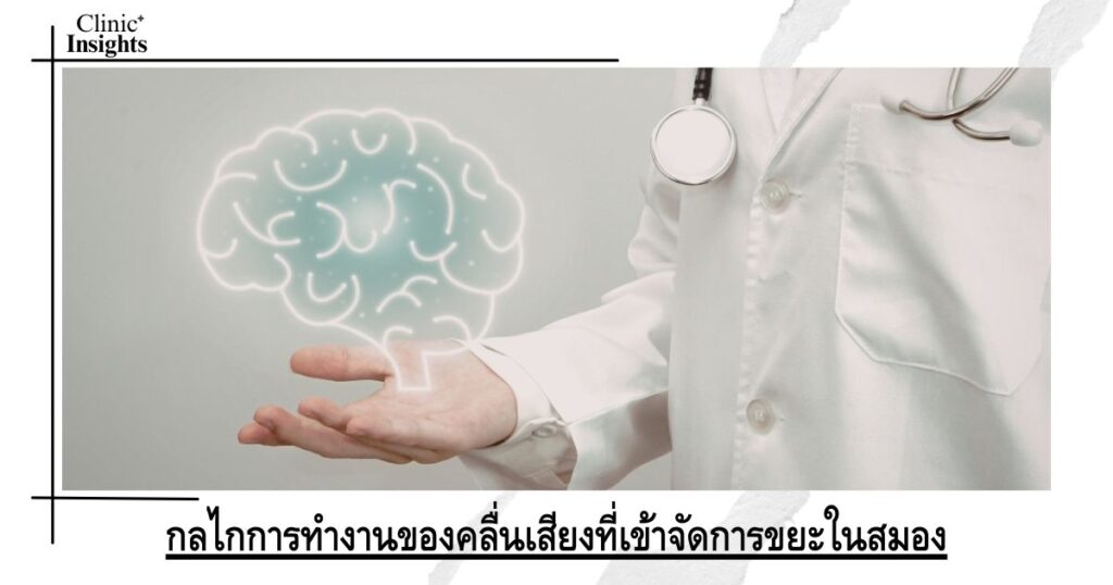 กลไกการทำงานของคลื่นเสียงที่เข้าจัดการขยะในสมอง