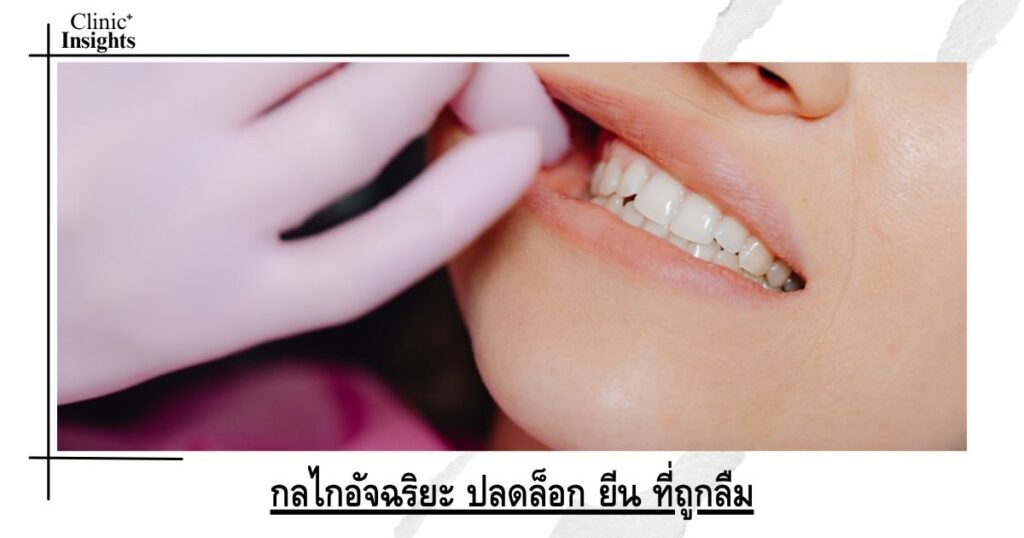 กลไกอัจฉริยะ ปลดล็อก ยีน ที่ถูกลืม