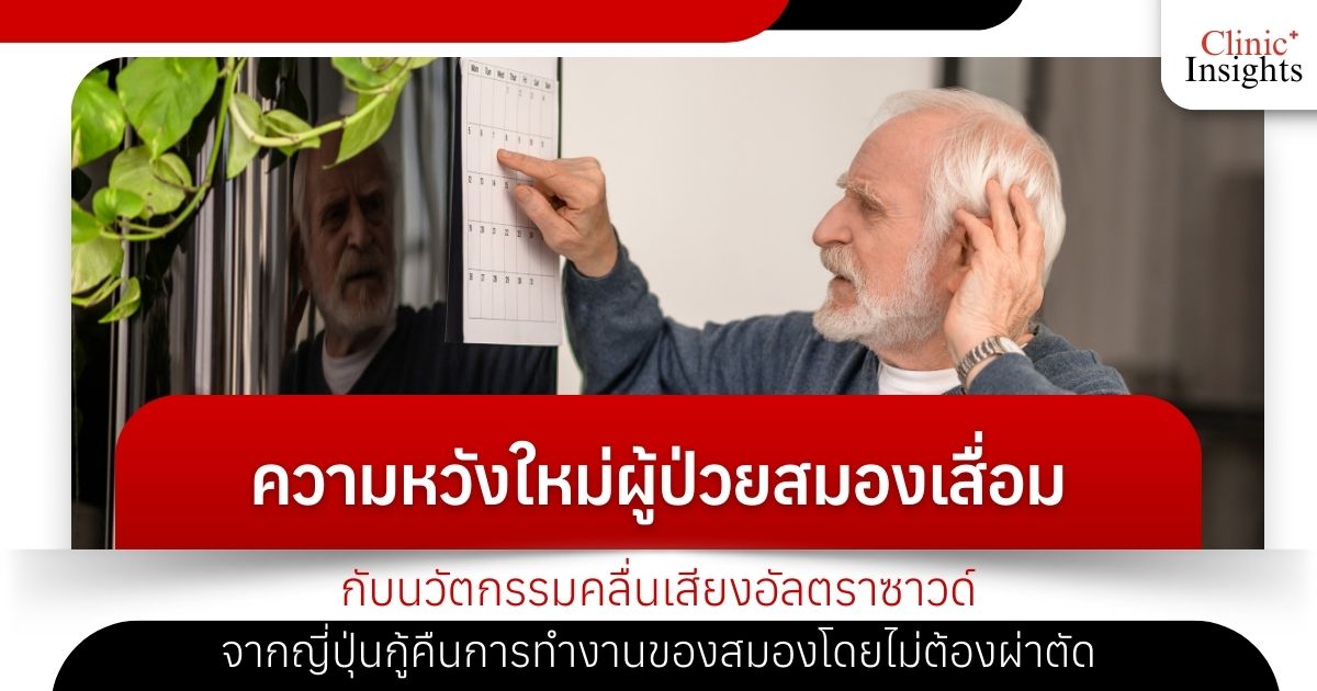 ความหวังใหม่ผู้ป่วยสมองเสื่อมกับนวัตกรรมคลื่นเสียงอัลตราซาวด์จากญี่ปุ่นกู้คืนการ