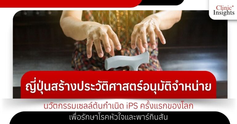 ญี่ปุ่นสร้างประวัติศาสตร์อนุมัติจำหน่ายนวัตกรรมเซลล์ต้นกำเนิด iPS